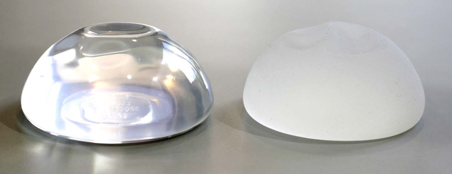 Smooth and textured breast augmentation silicone implants