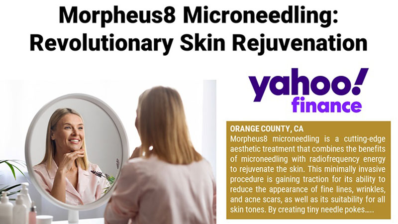 Morpheus8 Microneedling: Revolutionary Skin Rejuvenation