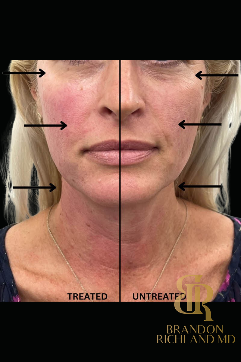 Forma Facial Before & After Image