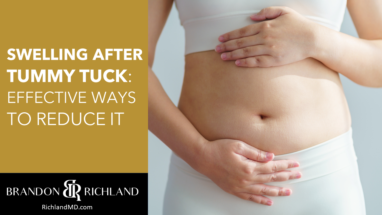 What Are the Side Effects of Tummy Tuck Surgery?