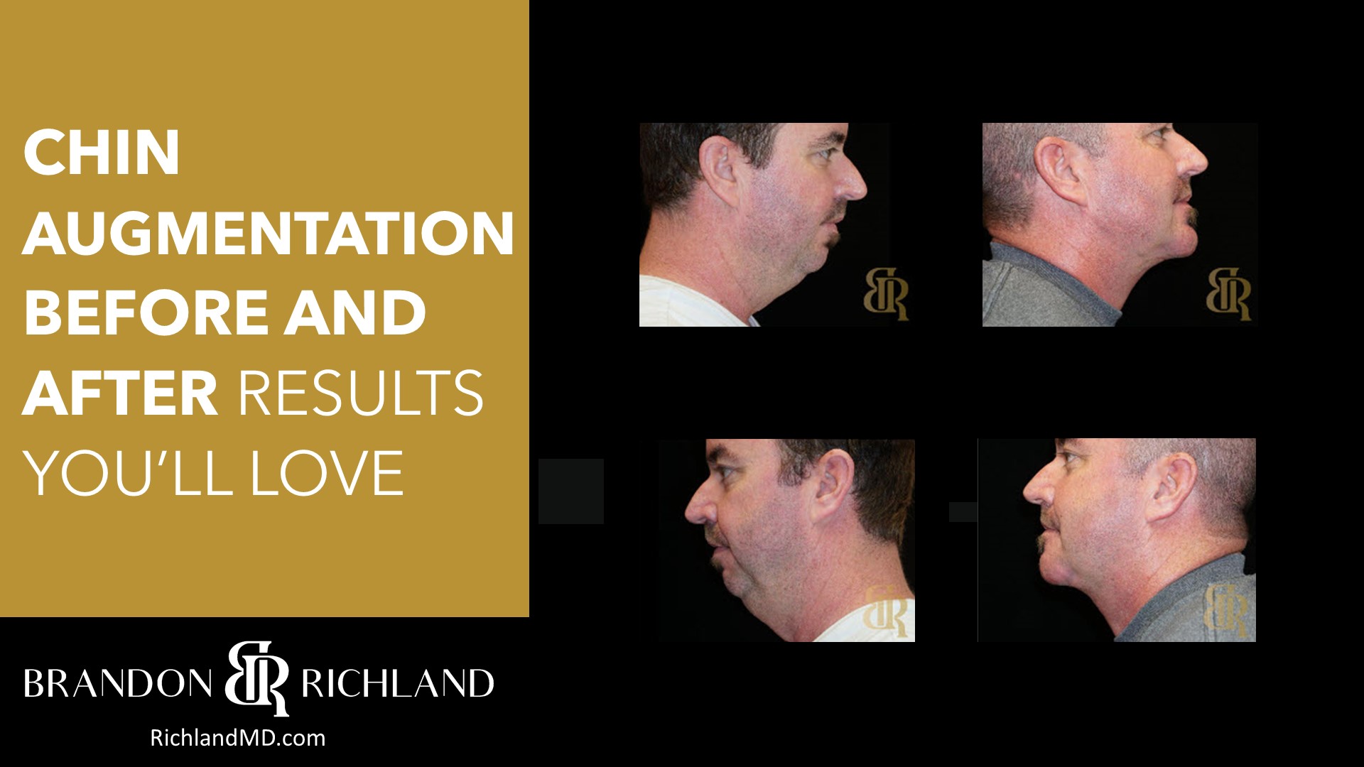 Dr. Brandon Richland, MD