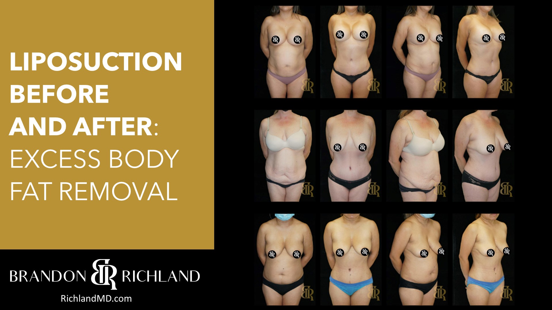 Dr. Brandon Richland, MD