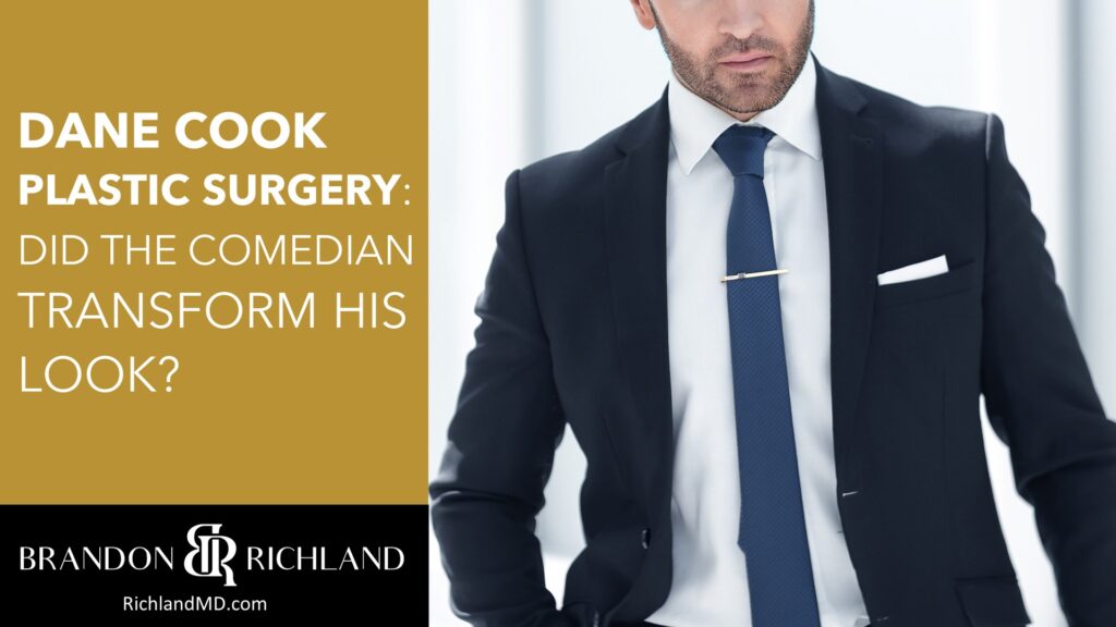 Dane Cook Plastic Surgery: Did the Comedian Transform His Look? | Dr ...