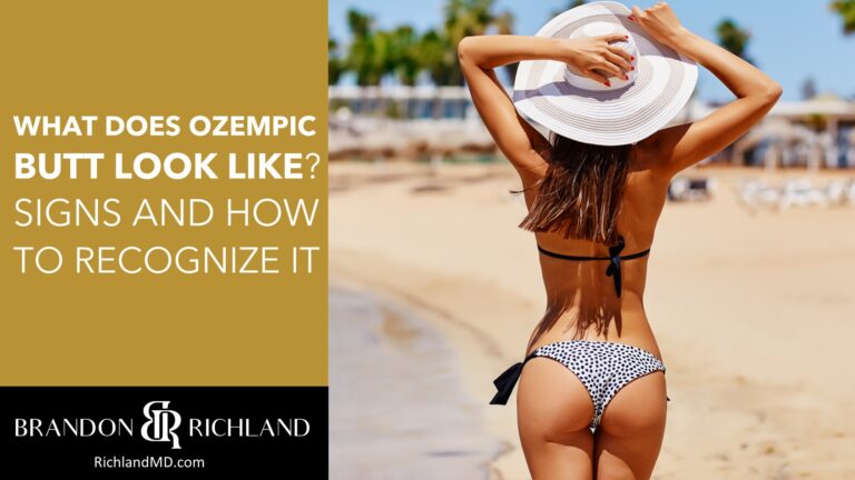 What Does Ozempic Butt Look Like? Signs and How to Recognize It | Dr