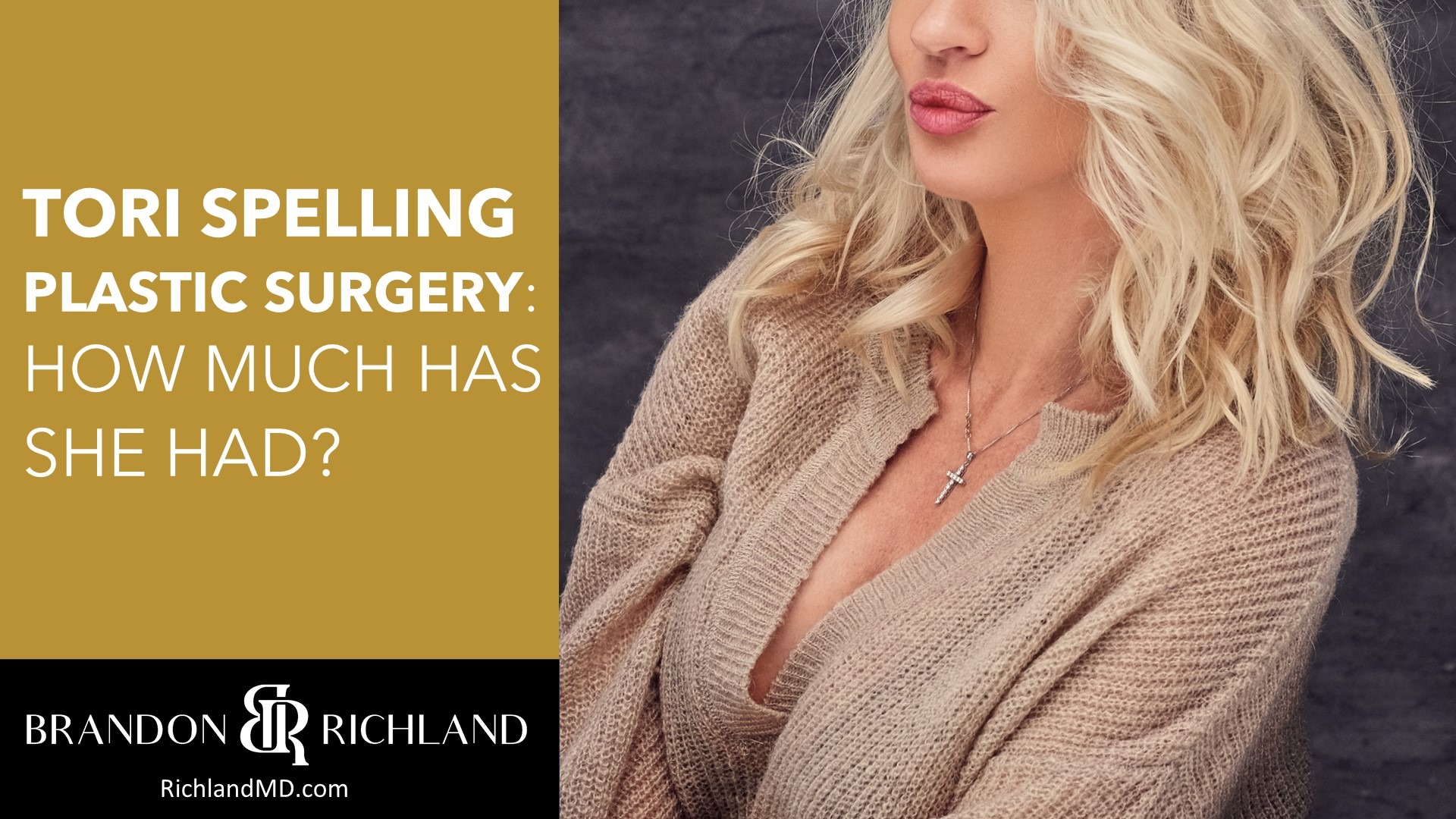 Tori Spelling Plastic Surgery: How Much Has She Had?