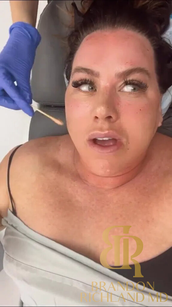Morpheus8 Orange County, CA: Amber Rose Facial Lounge 3 Months of Morpheus 8 Treatments in Newport Beach, CA By Dr. Brandon Richland, MD