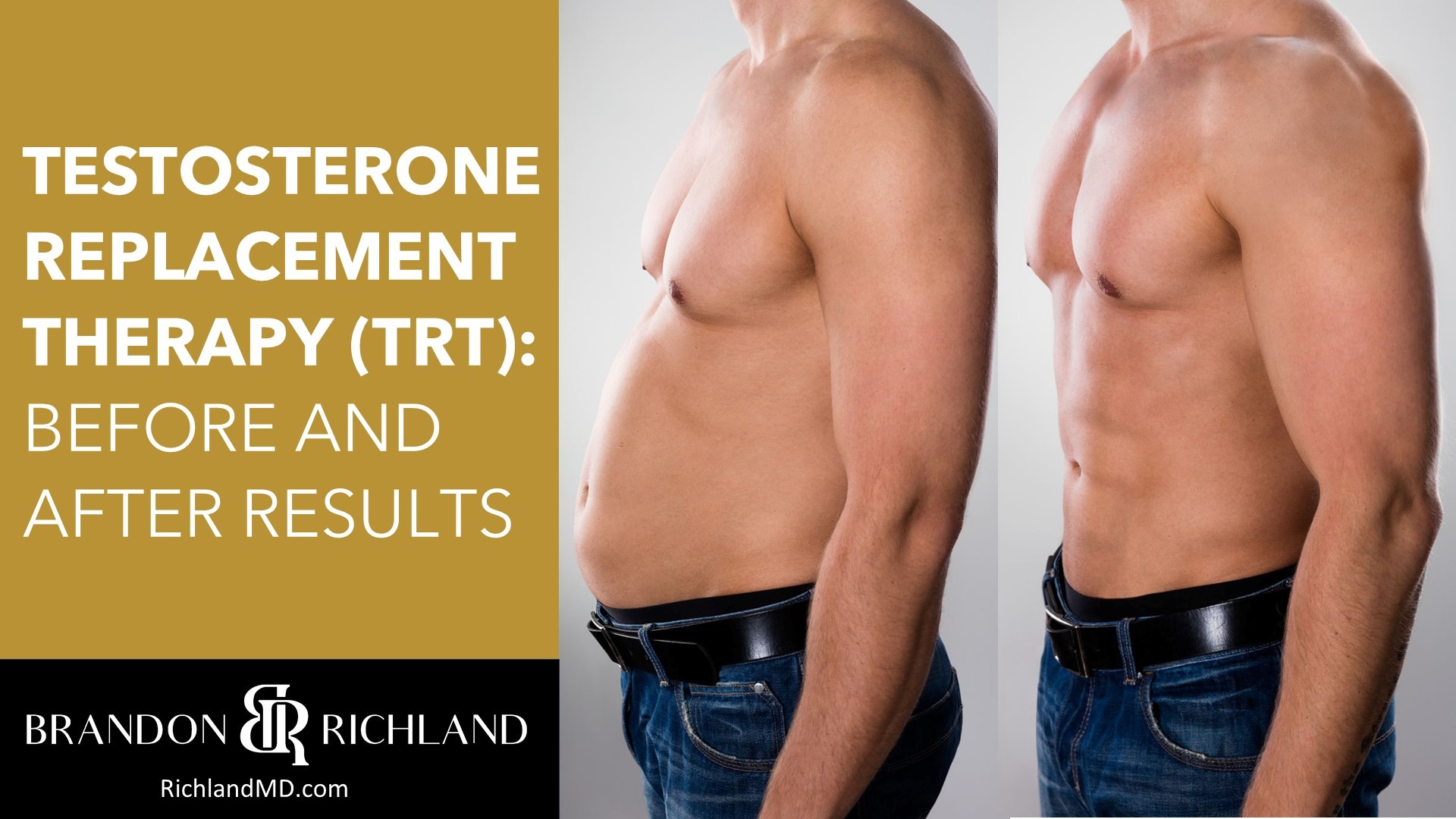 Testosterone Replacement Therapy (TRT): Before and After Results by Dr. Brandon Richland, MD