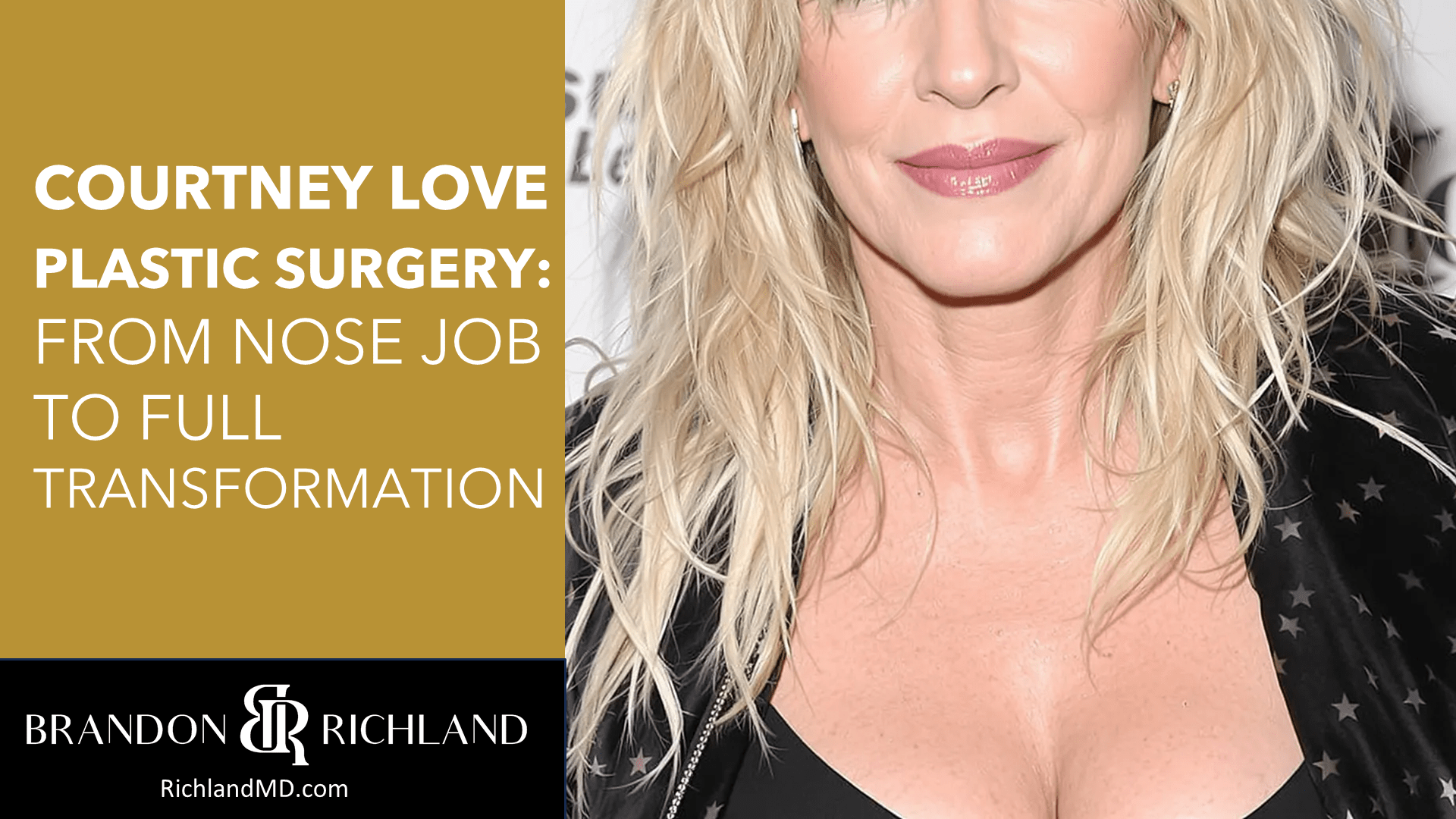 Courtney Love Plastic Surgery: From Nose Job to Full Transformation by Dr. Brandon Richland, MD