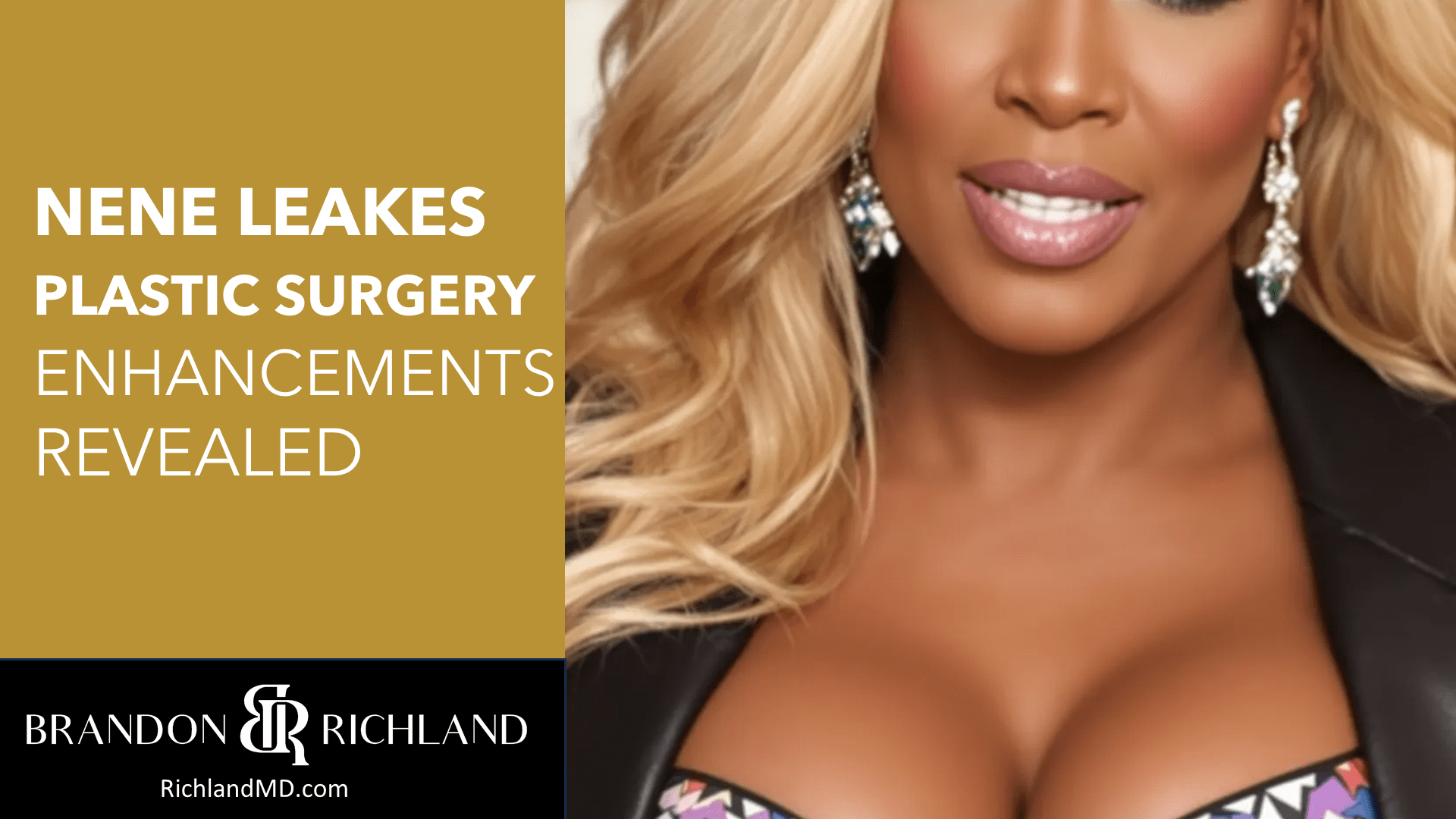 NeNe Leakes Plastic Surgery Enhancements Revealed by Dr. Brandon Richland, MD