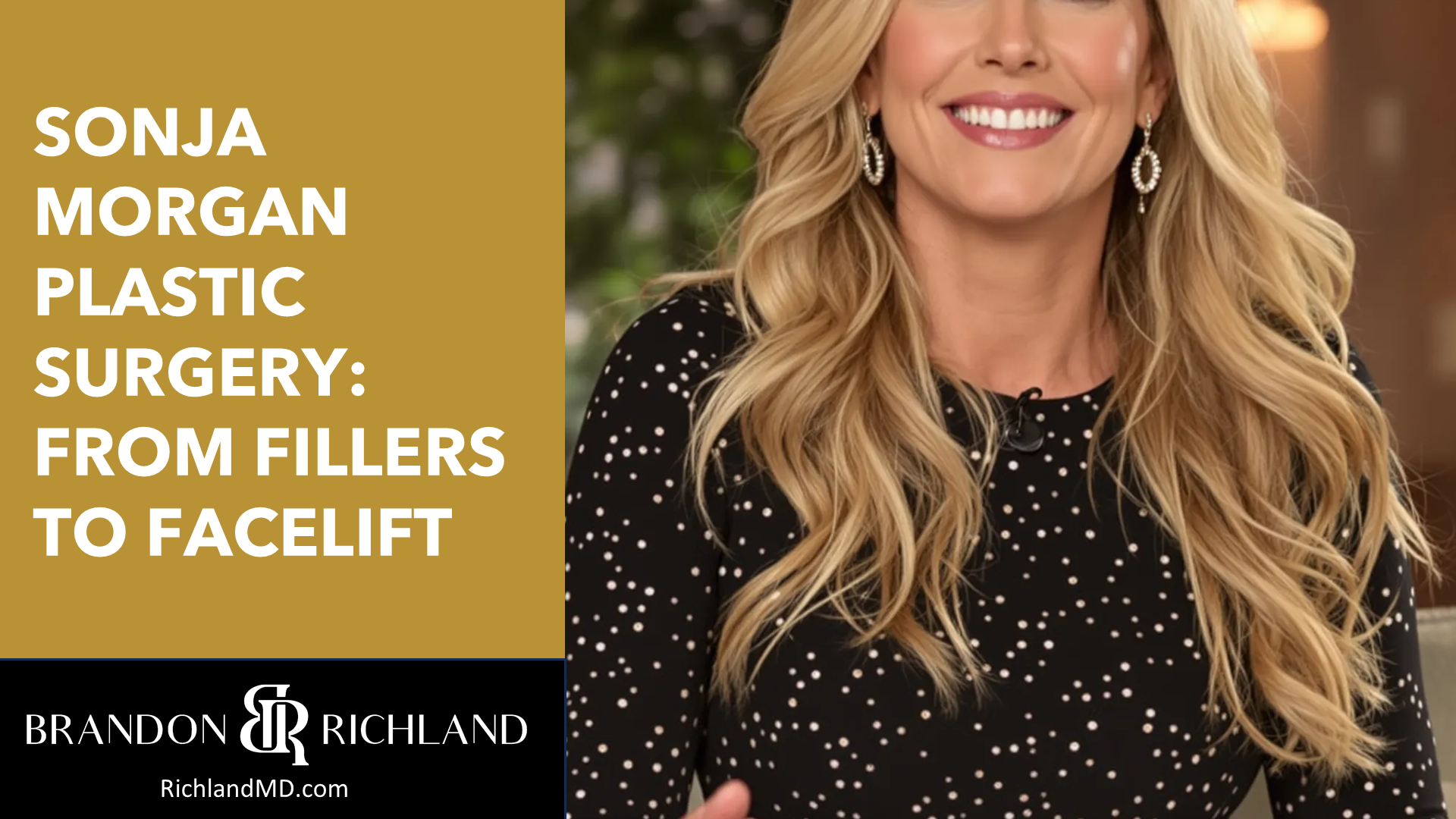 Sonja Morgan Plastic Surgery: From Fillers to Facelift by Dr. Brandon Richland, MD