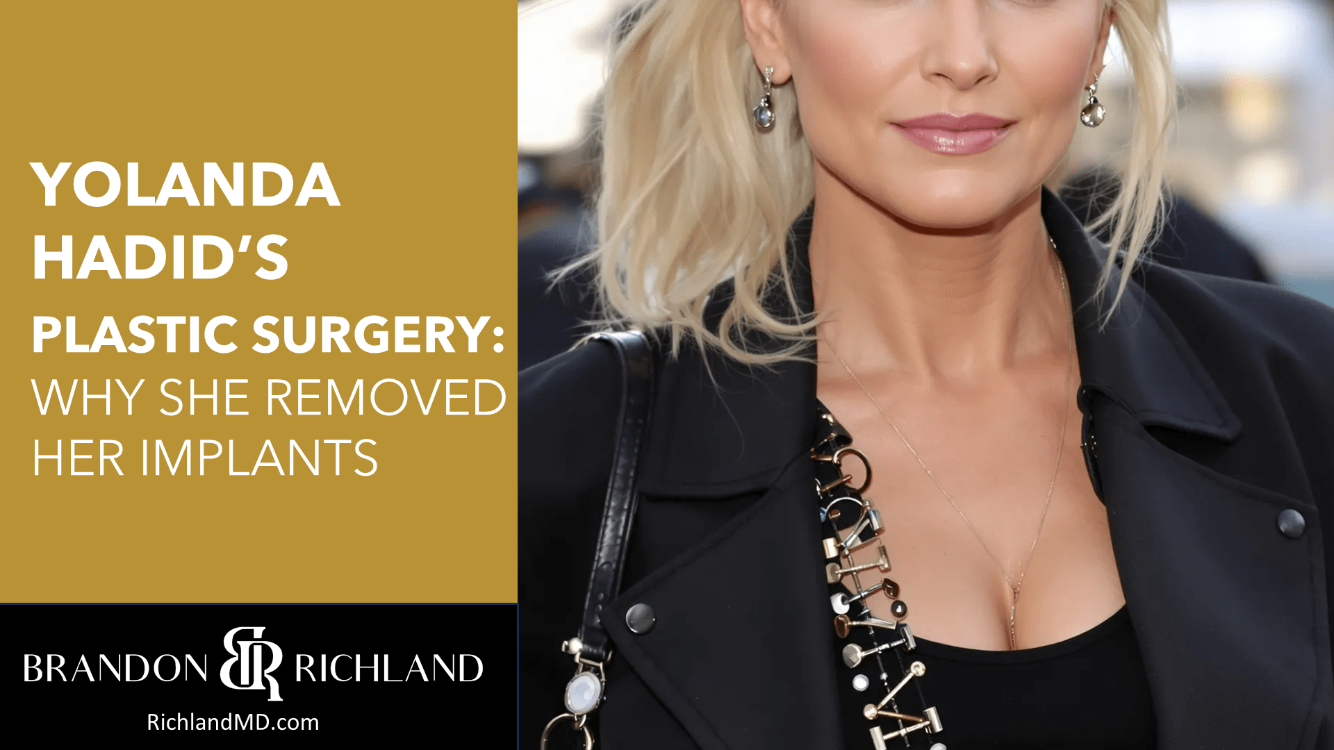 Yolanda Hadid’s Plastic Surgery: Why She Removed Her Implants by Dr. Brandon Richland, MD