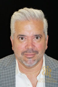 Blepharoplasty before and after, Patient 07 — Dr. Brandon Richland, Newport Beach